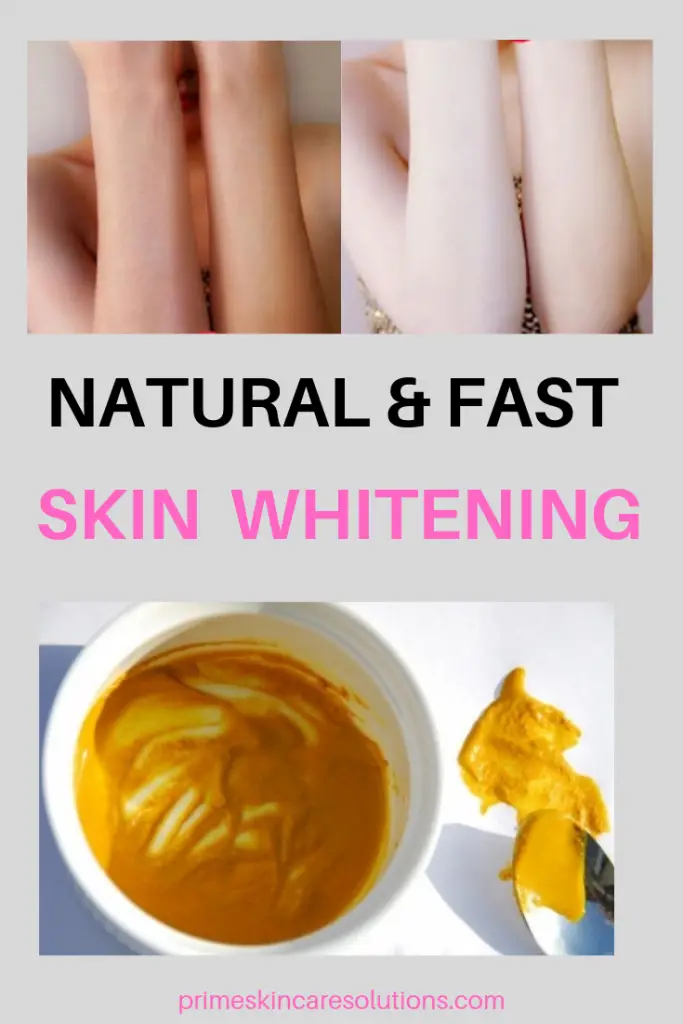 Natural & Fast Skin Whitening
