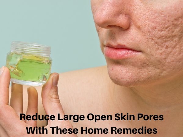 Reduce Large Open Skin Pores Fast With These Home Remedies